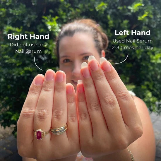 FENZORI | Nail Oil Pen (Cuticle's Oil)