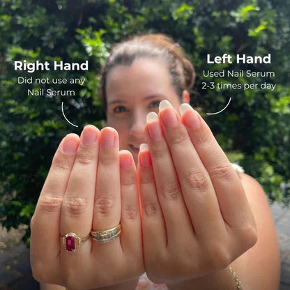 FENZORI | Nail Oil Pen (Cuticle's Oil)